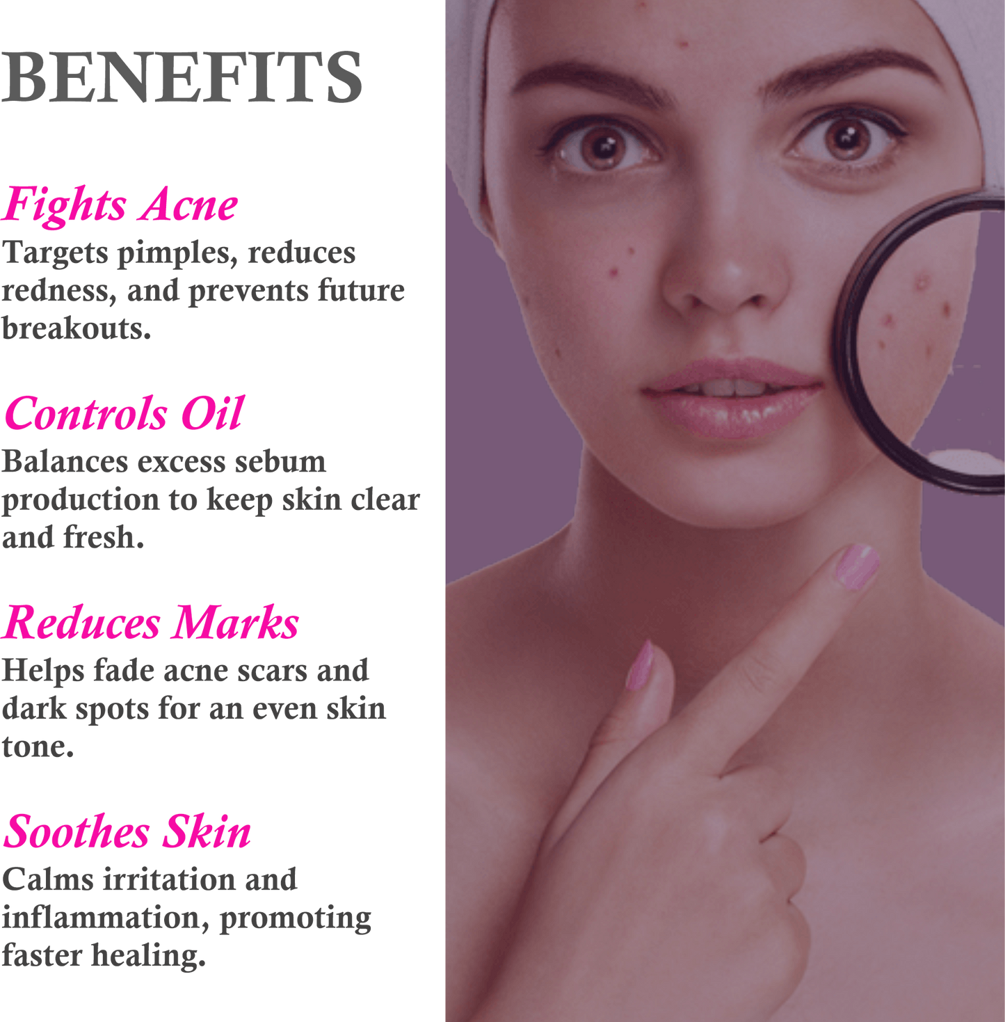 Key Benefits of Mountain Ayurveda Anti-Acne & Pimple Cream – Clears Acne & Prevents Breakouts
