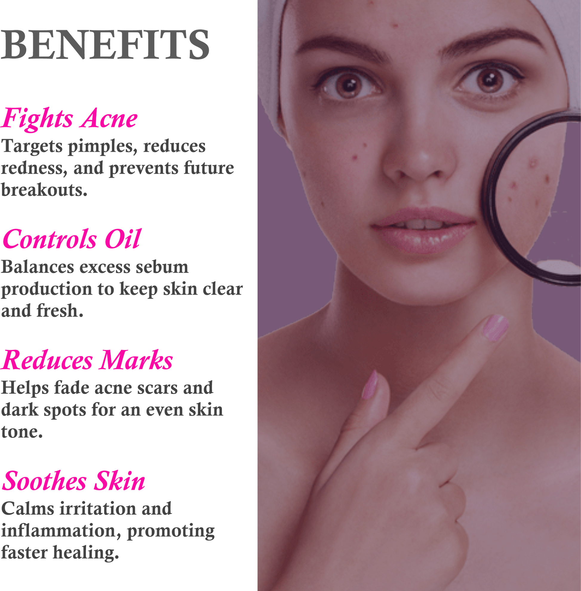 Key Benefits of Mountain Ayurveda Anti-Acne & Pimple Cream – Clears Acne & Prevents Breakouts
