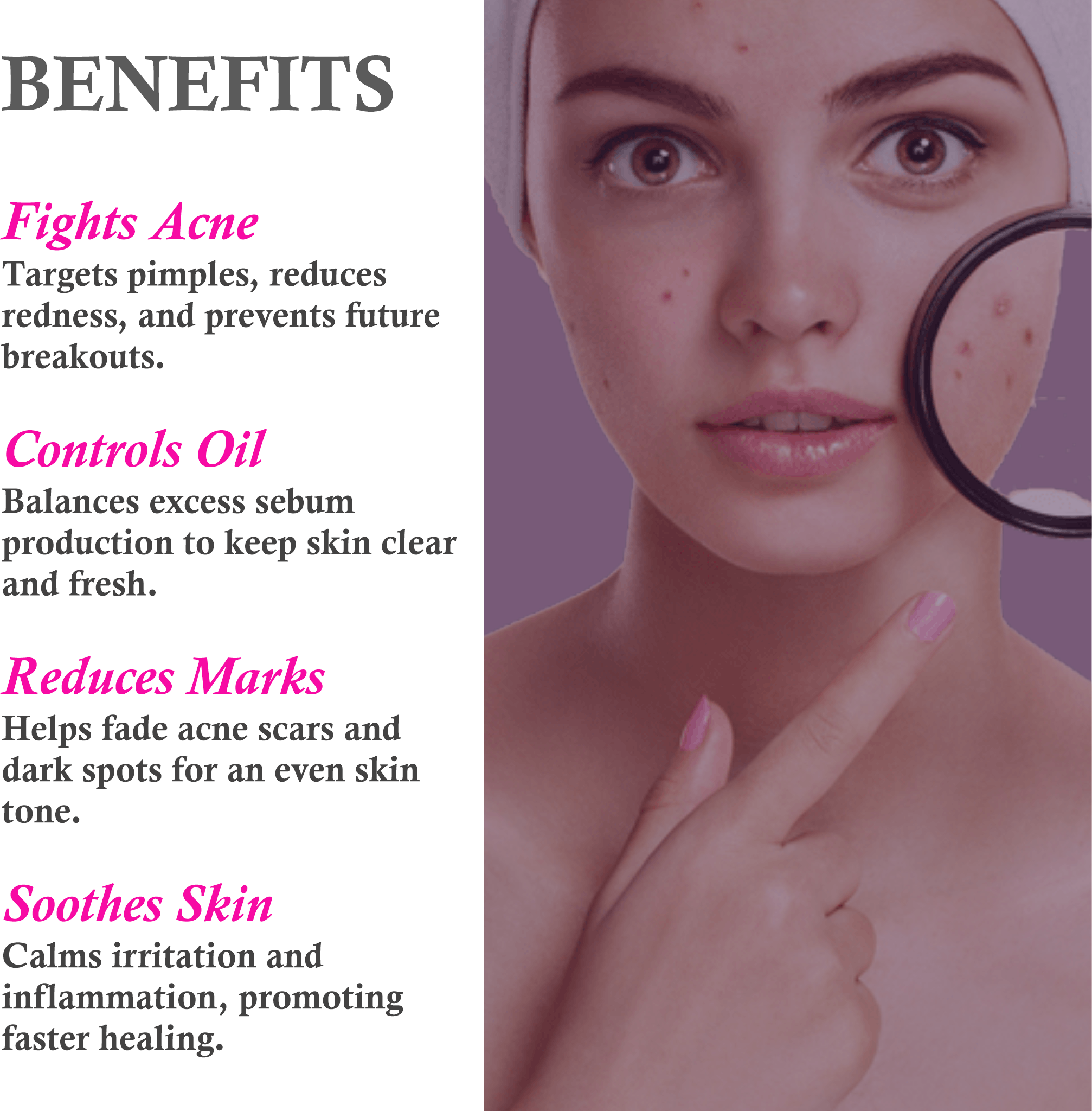 Key Benefits of Mountain Ayurveda Anti-Acne & Pimple Cream – Clears Acne & Prevents Breakouts
